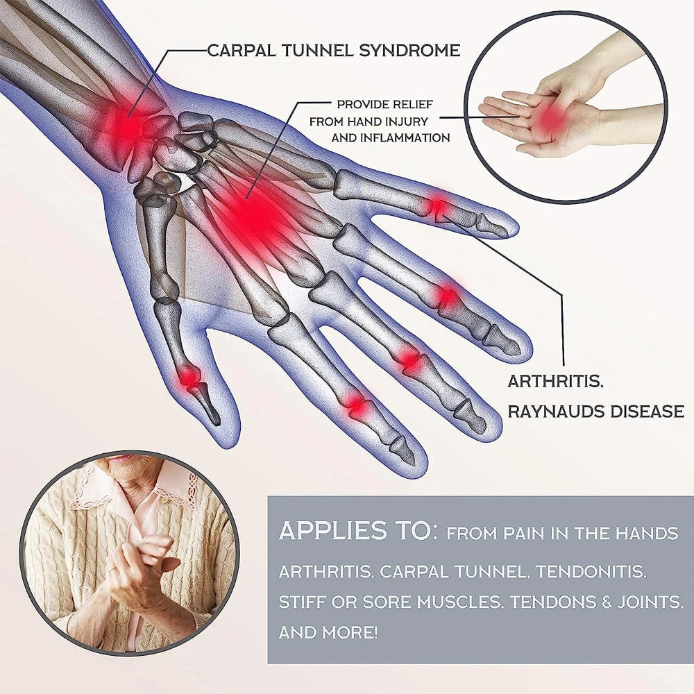 Guanti Da Artrite In Rame Per Dolore Alle Mani Osteoartrite Reumatoide Gonfiore E Tunnel Carpale Unisex